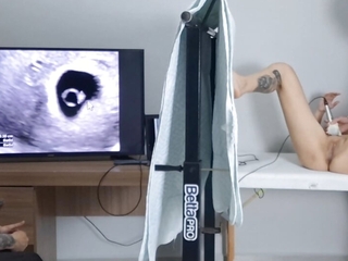 Cuckold takes wife to have an ultrasound!